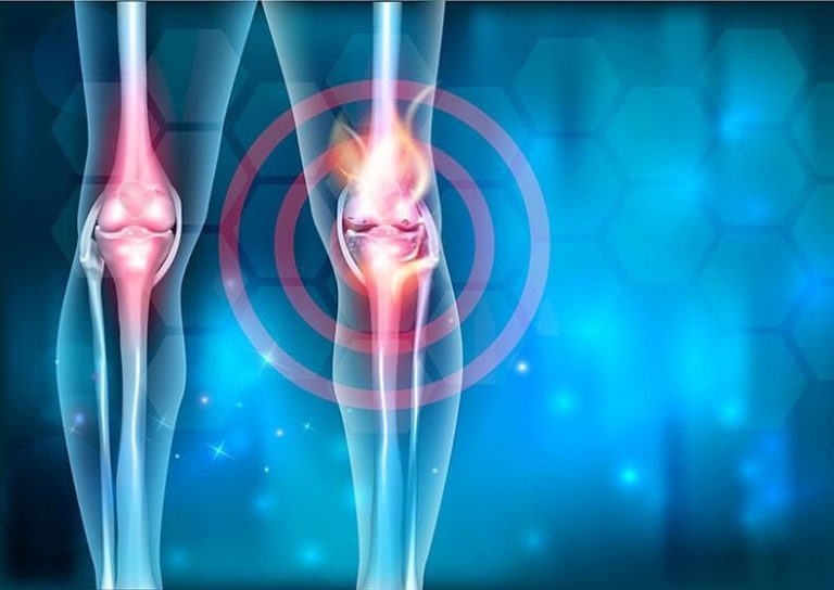 Здоровые суставы 7 лайфхаков, о которых не знали